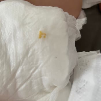 Sleepy Natural Bebek Bezlerinde Sert Cisim ve Sızıntı Sorunu