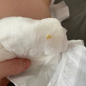 Sleepy Natural Bebek Bezlerinde Sert Cisim ve Sızıntı Sorunu