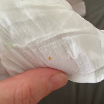 Sleepy Natural Bebek Bezlerinde Sert Cisim ve Sızıntı Sorunu