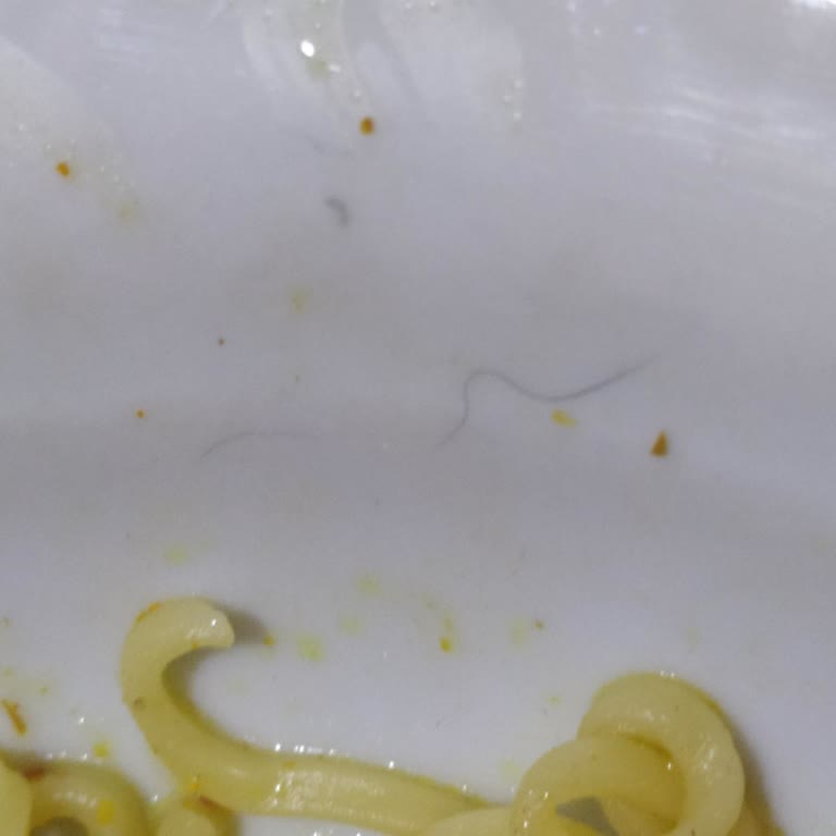 Aldığım Noodle Ürününden Kıl Çıkması Ve Müşteri Hizmetlerine Ulaşılamaması