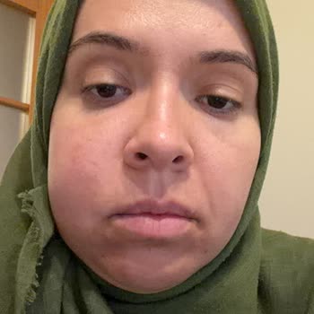 Diş Tedavisinde İhmal Sonucu Ölüm Tehlikesi Yaşadım