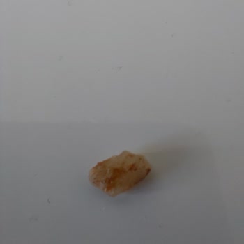 Yer Fıstıklı Bar İçinden Taş Çıkması Ve Yanıtsız Kalan Şikayet