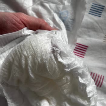 Molfix Bebek Bezlerinde Şeffaf Parçalar Ve Ciltte Kızarıklık Sorunu