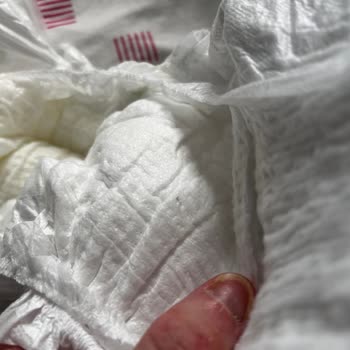 Molfix Bebek Bezlerinde Şeffaf Parçalar Ve Ciltte Kızarıklık Sorunu