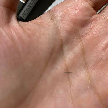 Haşhaşlı Revani İçinde Metal Parçası Buldum, Ölümcül Tehlike Atlattım