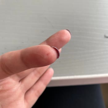 Haşhaşlı Revani İçinde Metal Parçası Buldum, Ölümcül Tehlike Atlattım