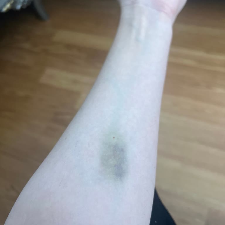 Taze Süt Zehirlenmesi: Aile Boyu Sağlık Sorunu Yaşadık