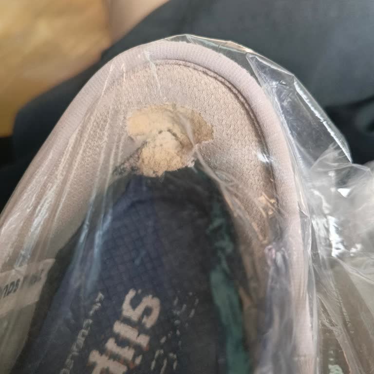 Kısa Sürede Deforme Olan Skechers Ayakkabı İçin Garanti Reddi Ve Mağduriyet