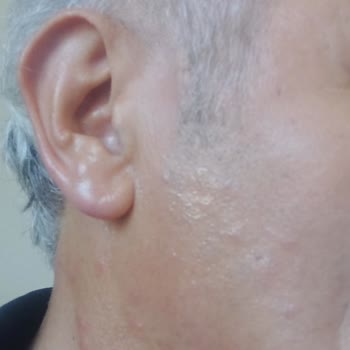 Venüs Otelde Konaklama Sonrası Vücudumda Yayılan Kızarıklıklar Ve Hijyen Endişesi