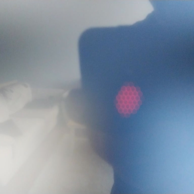 LG Televizyonumun Arızası Çözülmüyor, Sürekli Oyalıyorlar!