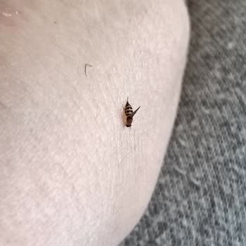 Red Bull Kutusunda Böcek Çıktı, Hijyen Ve Sağlık Endişesi Yaşadım