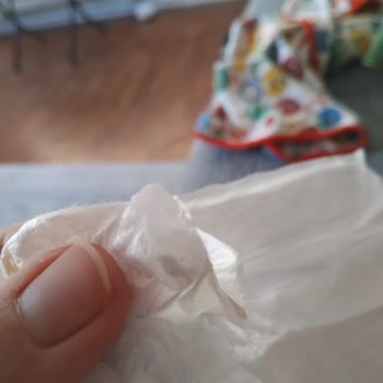 Molfix Bebek Bezinde Tekrarlayan Yabancı Madde Sorunu: Güvenlik Endişesi