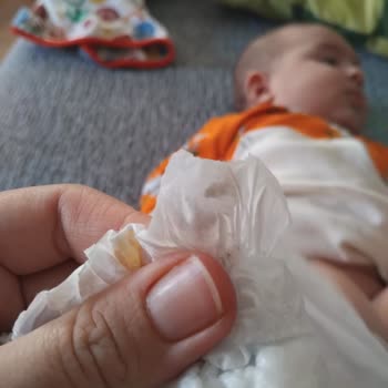 Molfix Bebek Bezinde Tekrarlayan Yabancı Madde Sorunu: Güvenlik Endişesi