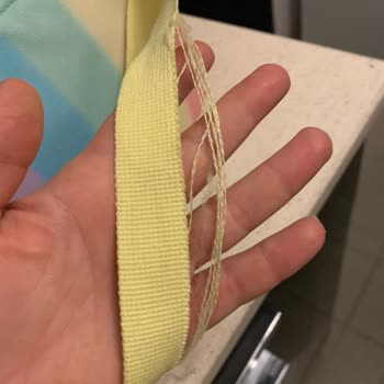 Kısa Sürede Deforme Olan Beslenme Çantası Ve Garanti Sorunu