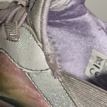 Skechers Çocuk Ayakkabısı Kısa Sürede Yıprandı Garanti Reddedildi