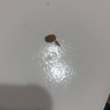 Fıstıklı Baklavada Fıstık Kabuğu Çıkması Ve Özür Beklentisi