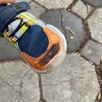 Kısa Sürede Deforme Olan Ayakkabı İçin İade Talebi