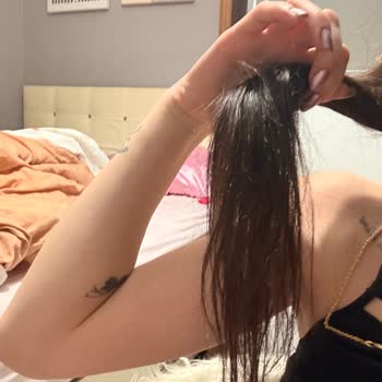 Saç Kaynak İşlemi Sonrası Yetersiz Saç Ve Ücret İadesi Sorunu