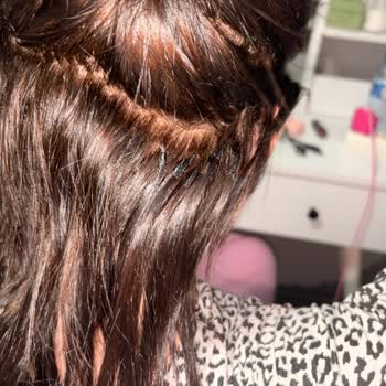 Saç Kaynak İşlemi Sonrası Yetersiz Saç Ve Ücret İadesi Sorunu