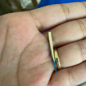 Bebek Bezinde Yabancı Cisim Tehlikesiyle Karşılaştım