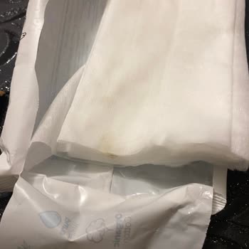 Sleepy Islak Mendilde Küf Ve Cilt Tahrişi Nedeniyle Hastane Masrafı