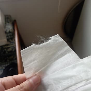 Jenny Willy Bebek Bezinde Bant Kopma Sorunu Ve Mağduriyet