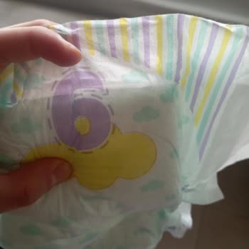 Jenny Willy Bebek Bezinde Bant Kopma Sorunu Ve Mağduriyet