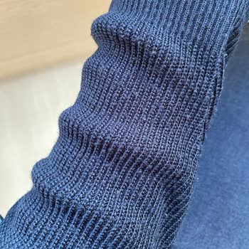 Oxxo'dan Alınan Kazakta Kısa Sürede Tüylenme Ve Deformasyon Sorunu