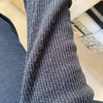 Oxxo'dan Alınan Kazakta Kısa Sürede Tüylenme Ve Deformasyon Sorunu