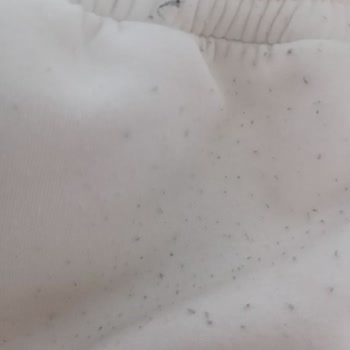 Sipariş Ettiğim Eşofmanlarda Tiftiklenme Ve Değişim Reddi Mağduriyeti