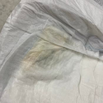 Molfix Bebek Bezinde Küf Sorunu Ve Sağlık Endişesi