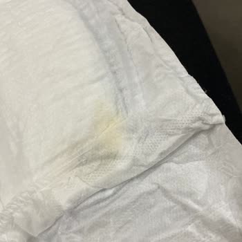 Molfix Bebek Bezinde Küf Sorunu Ve Sağlık Endişesi