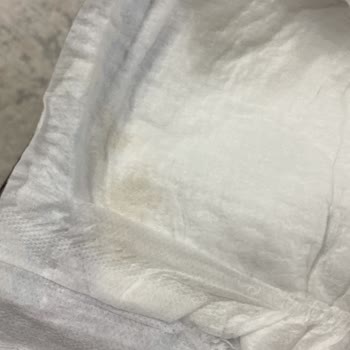 Molfix Bebek Bezinde Küf Sorunu Ve Sağlık Endişesi