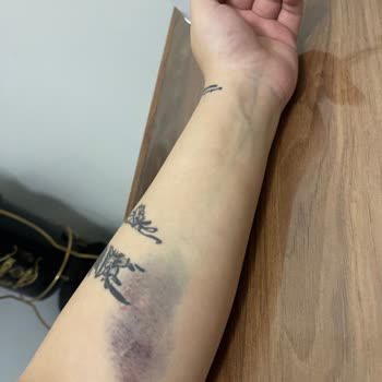 Doğumhane Sürecinde Tekrarlanan Yanlış Uygulamalar Nedeniyle Yaşanan Mağduriyet