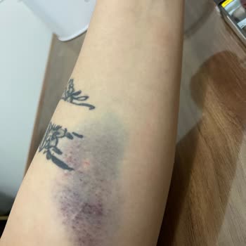 Doğumhane Sürecinde Tekrarlanan Yanlış Uygulamalar Nedeniyle Yaşanan Mağduriyet