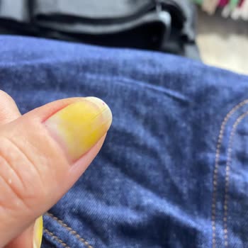 Flormar Oje Tırnaklarımı Sararttı, Müşteri Hizmetlerinden Dönüş Alamadım