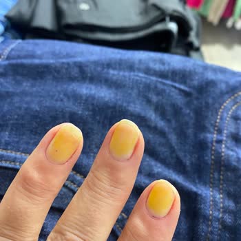 Flormar Oje Tırnaklarımı Sararttı, Müşteri Hizmetlerinden Dönüş Alamadım