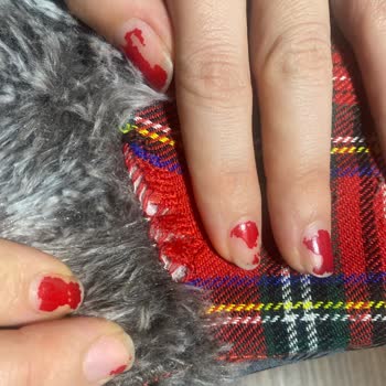 Kısa Sürede Kullanılamaz Hale Gelen Twiggy Panduf Ve Müşteri Hizmetleri Sorunu