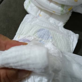 Molfix Bebek Bezinde Anormal Tortu Ve Ciltte Ciddi Tahriş Sorunu Yaşadım