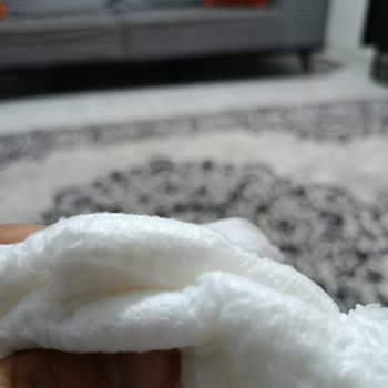 Molfix Bebek Bezinde Anormal Tortu Ve Ciltte Ciddi Tahriş Sorunu Yaşadım