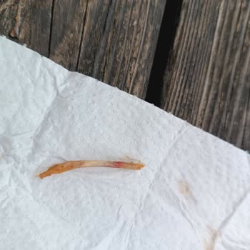 Tavuk Dönerin İçinden Çıkan Kemik Dişimi Kırıyordu