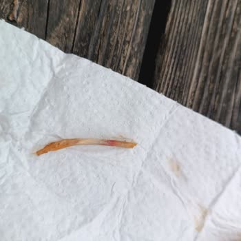 Tavuk Dönerin İçinden Çıkan Kemik Dişimi Kırıyordu