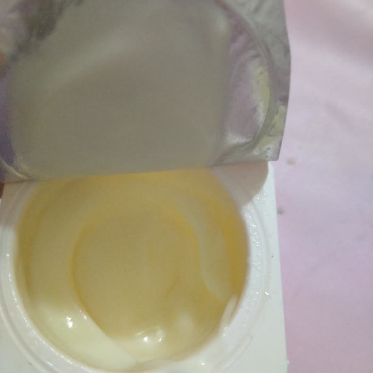 A101 Bozuk Çıkan Bebek Ürünü İçin İade Talebim Yanıtsız Kaldı