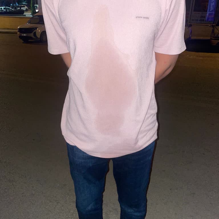 Sıcak Çayla Yanık Ve İlgisizlik: Fabregas Cafe'de Büyük Mağduriyet