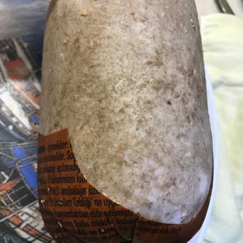 Torku Kavurma Sonrası Sağlık Sorunu Ve Yağ-Kıkırdak Şikayeti