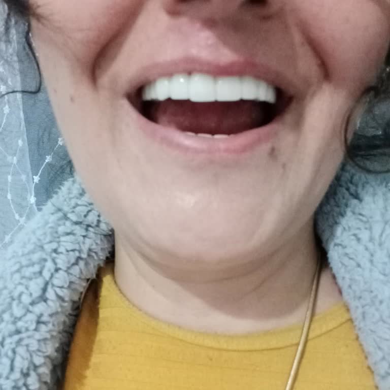 Birdent Ağız Ve Diş Sağlığı Polikliniği Protezlerin Hazırlanması Aşamasında Birçok Sorun Yaşadım