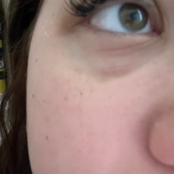 İpek Kirpik Uygulaması Sonrası Kalitesiz Hizmet Ve Mağduriyet