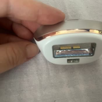 Philips IPL Cihazında Erken Deformasyon Ve Yetersiz Servis Desteği