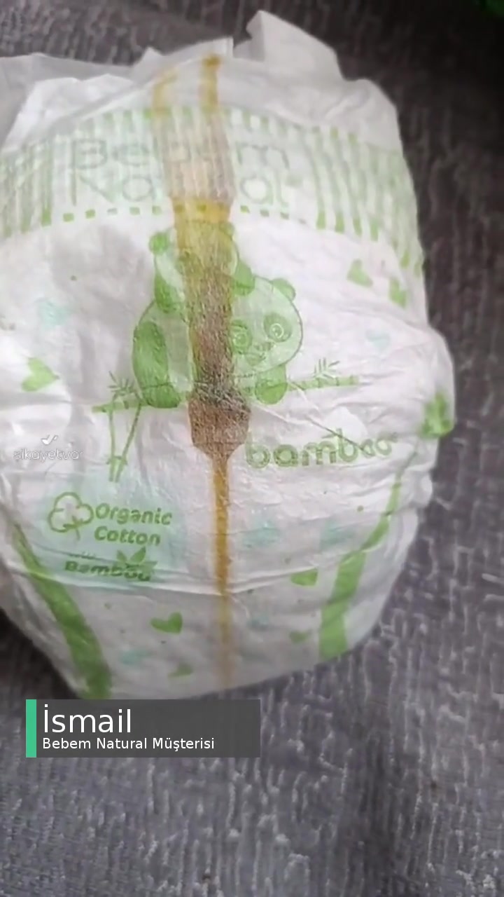 Bebem Natural Bezlerden Çıkan Anlamsız Lekeler! videonun kapak resmi