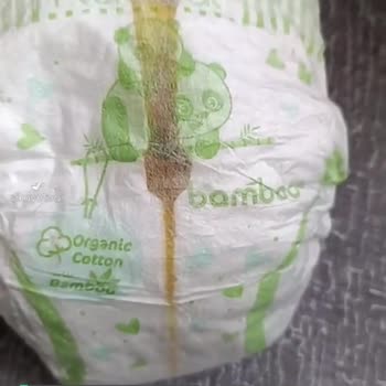 Bebem Natural Bezlerden Çıkan Anlamsız Lekeler!